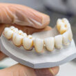 How Much Does a Dental Bridge Cost Without Insurance?