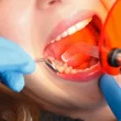 How Long Does Numbness Last After Dental Filling