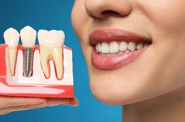 8 Signs That You Need Dental Implants