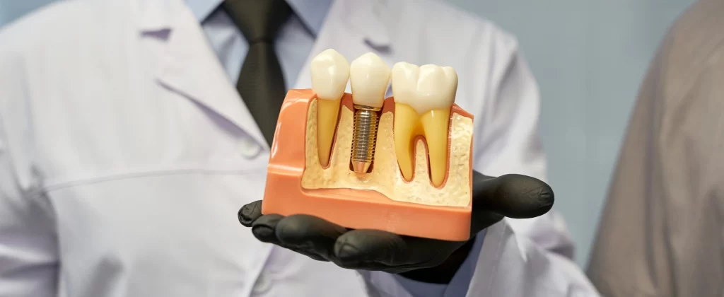 Does Medicare Cover Dental Implants