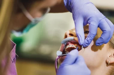Dental Headgear