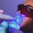 Laser Dental Cleaning