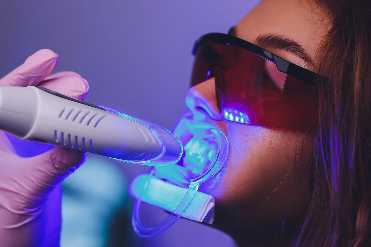 Laser Dental Cleaning