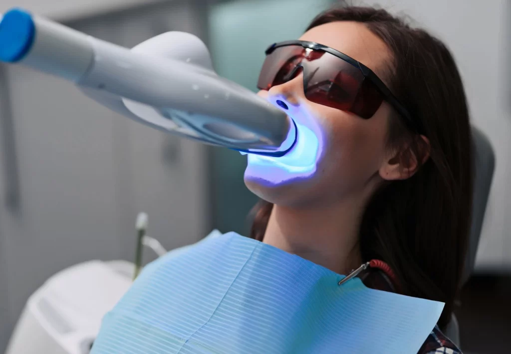 Laser Dental Cleaning