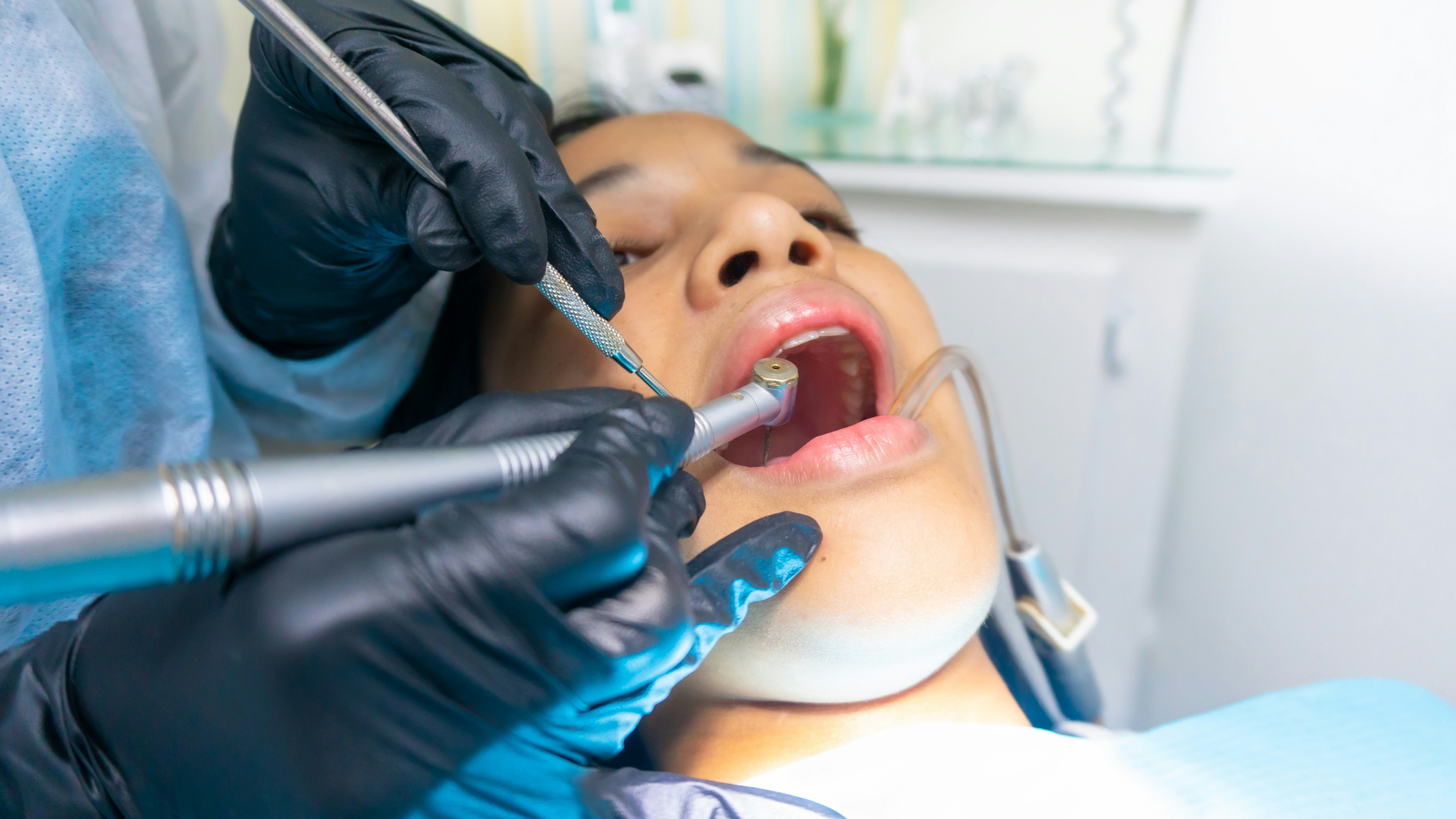 Here’s Everything to Know About Dental Bone Grafting: Is It Right for You?