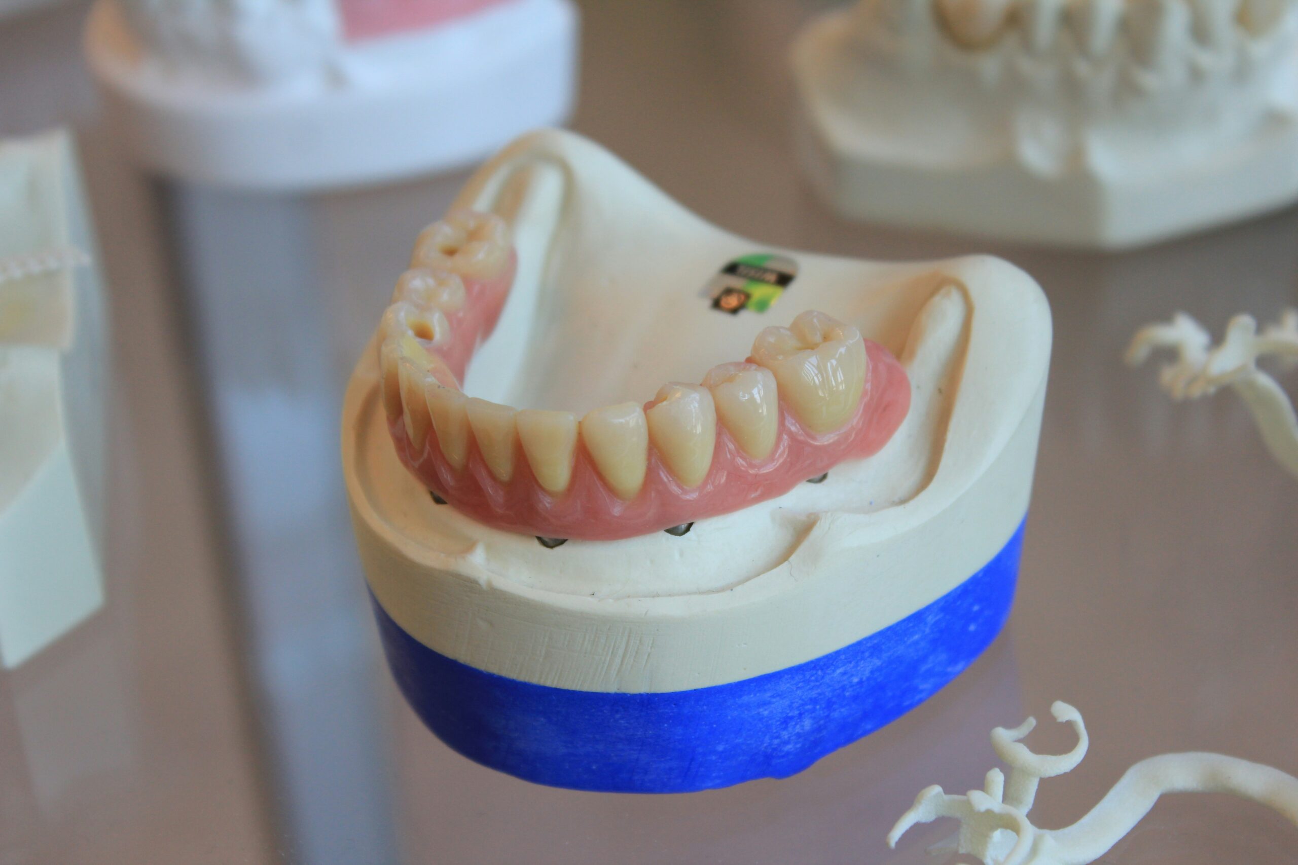 Dental Cap vs Crown: Which One Is Better for You?